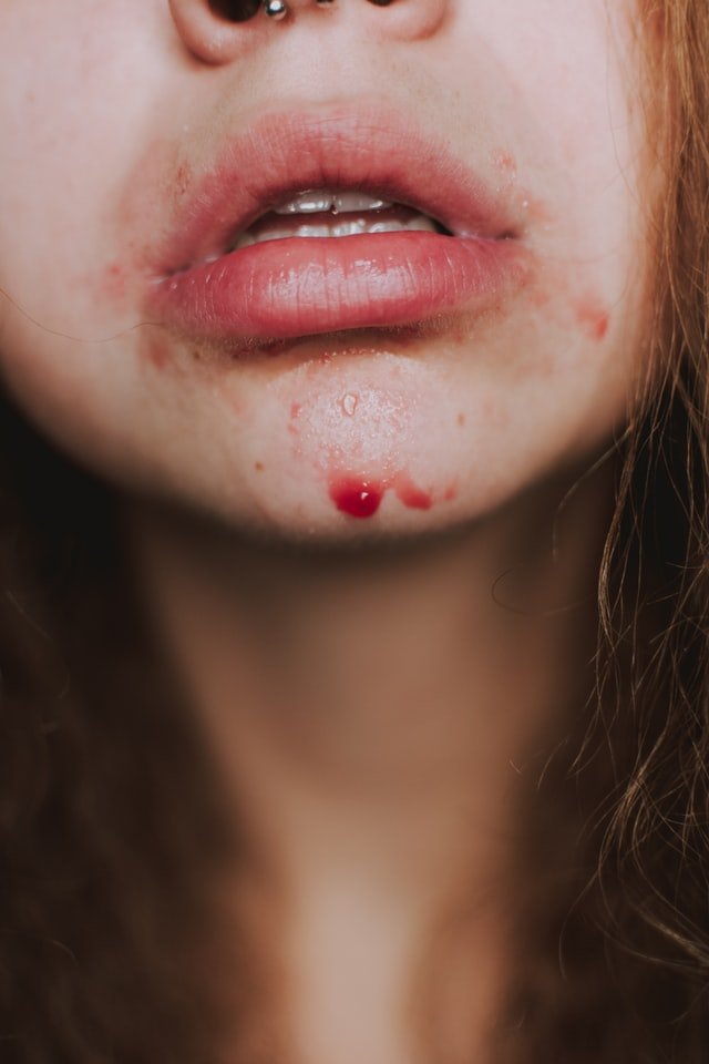 Sentencian a mujer que hirió en el rostro a una adolescente en discoteca Magno